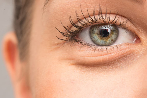 how-to-get-rid-of-puffy-eyes