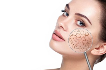 Common Causes of Dry Skin